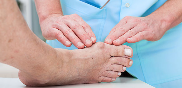 Doctor checking bunion on foot
