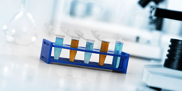 Micro tubes with biological samples waiting for DNA testing