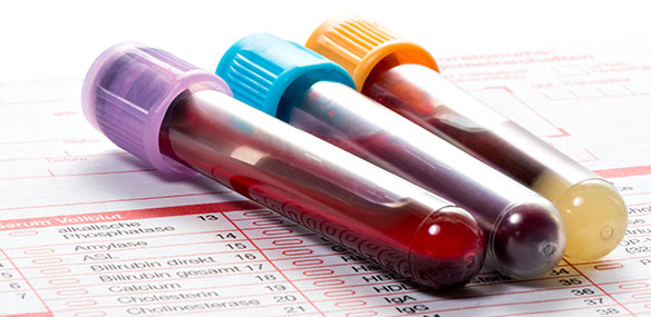 Blood vials for testing