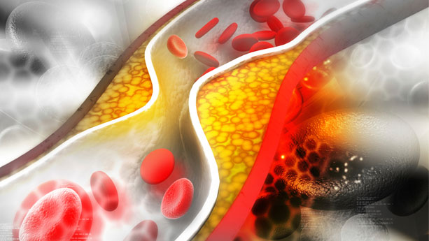 Cholesterol: What You Need to Know 