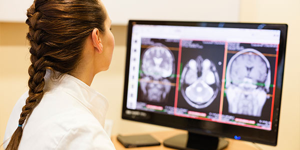 Female doctor analyzing MRI brain scans