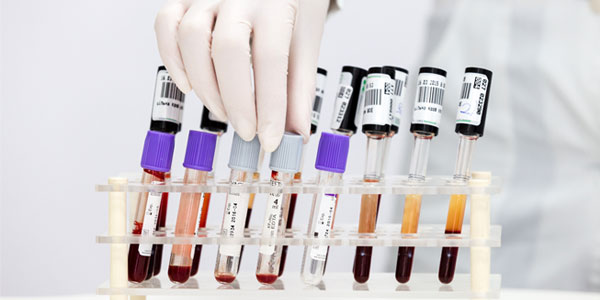 Vials of blood in laboratory